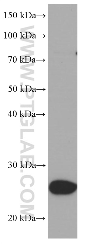 UCP2 Monoclonal antibody