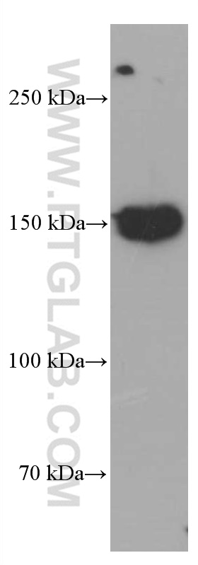 CD21 Monoclonal antibody