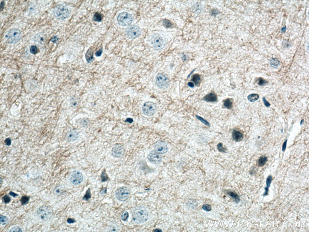 MAG Monoclonal antibody