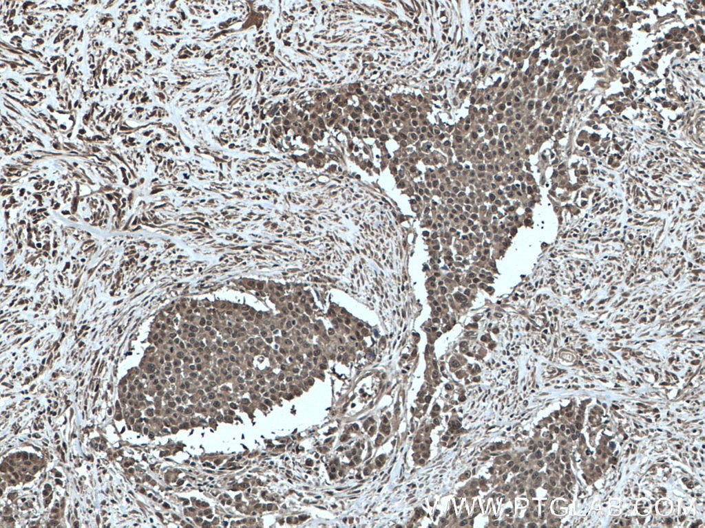 GSTP1 Monoclonal antibody