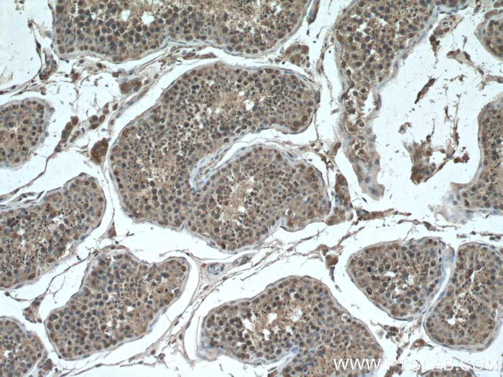 CHCHD4 Monoclonal antibody