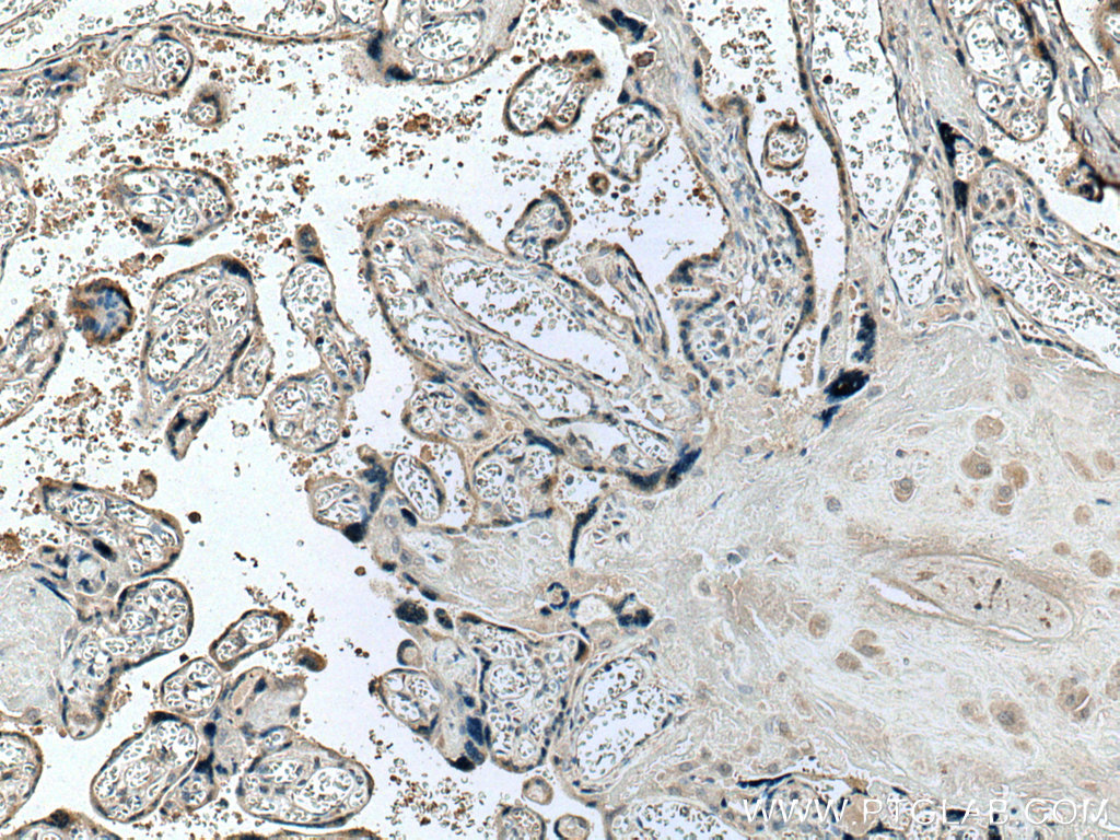 Placental lactogen Monoclonal antibody