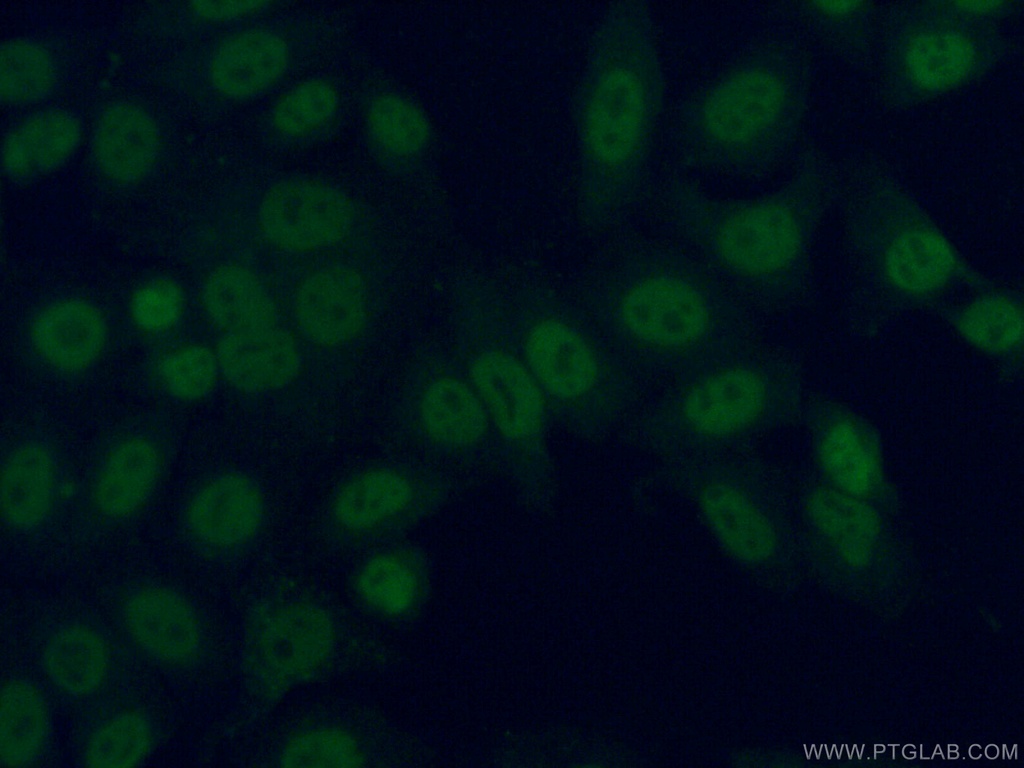 ARNT,HIF1B Monoclonal antibody