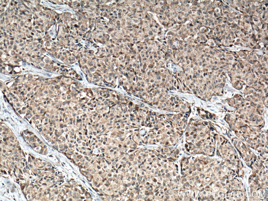 IL-1 Beta Monoclonal antibody