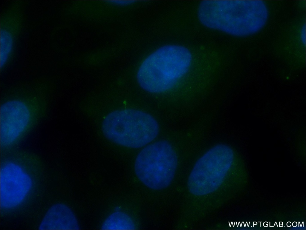 ARL13B Monoclonal antibody