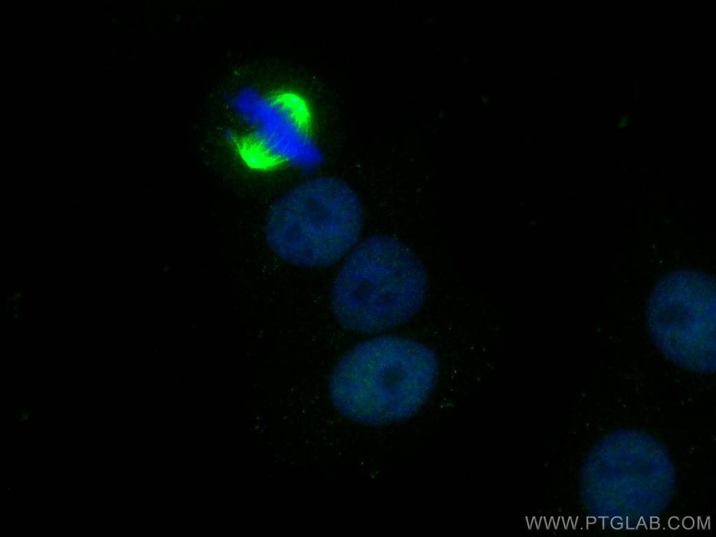 SRF Monoclonal antibody