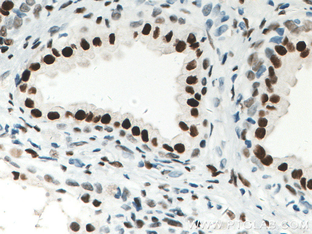 AR Monoclonal antibody
