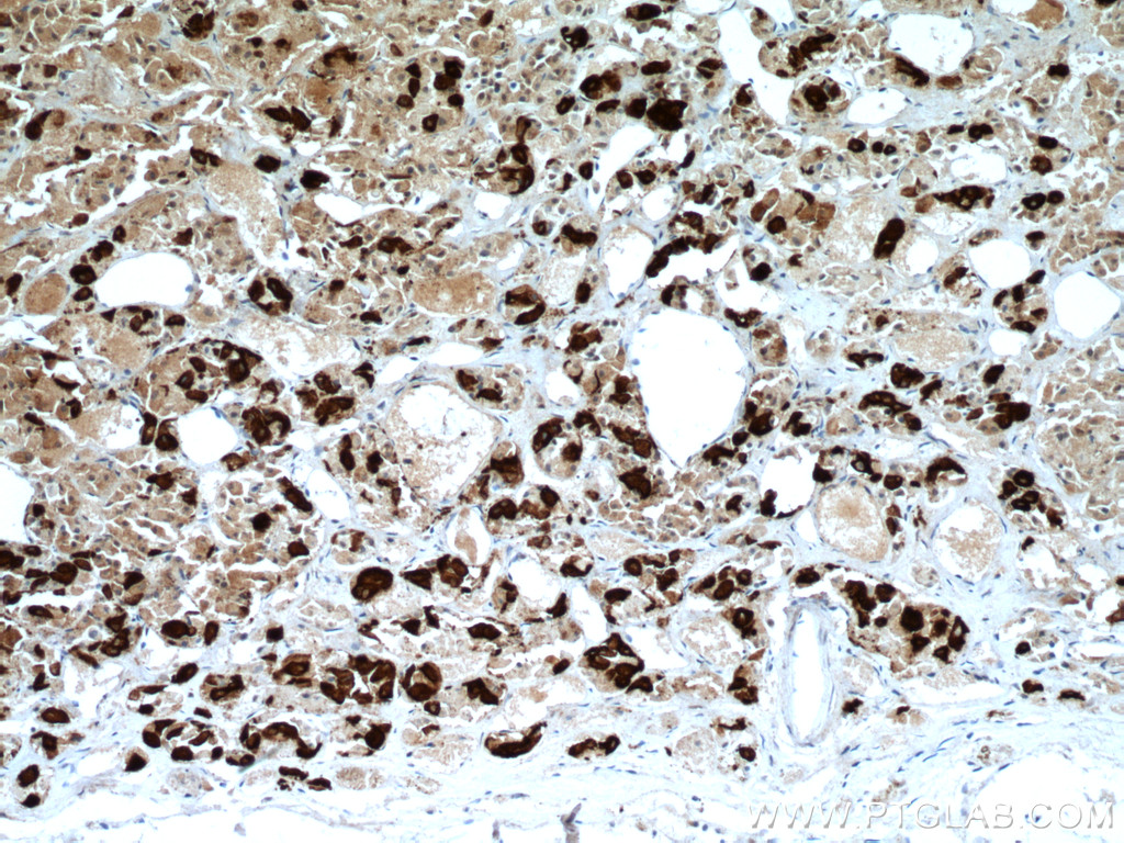 TSH Beta Monoclonal antibody