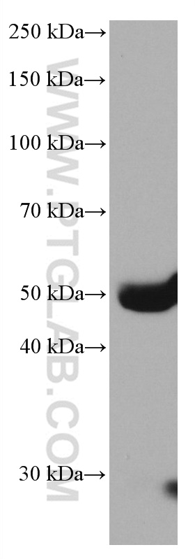 Factor X Monoclonal antibody