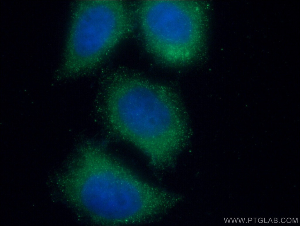 TRAF4 Monoclonal antibody