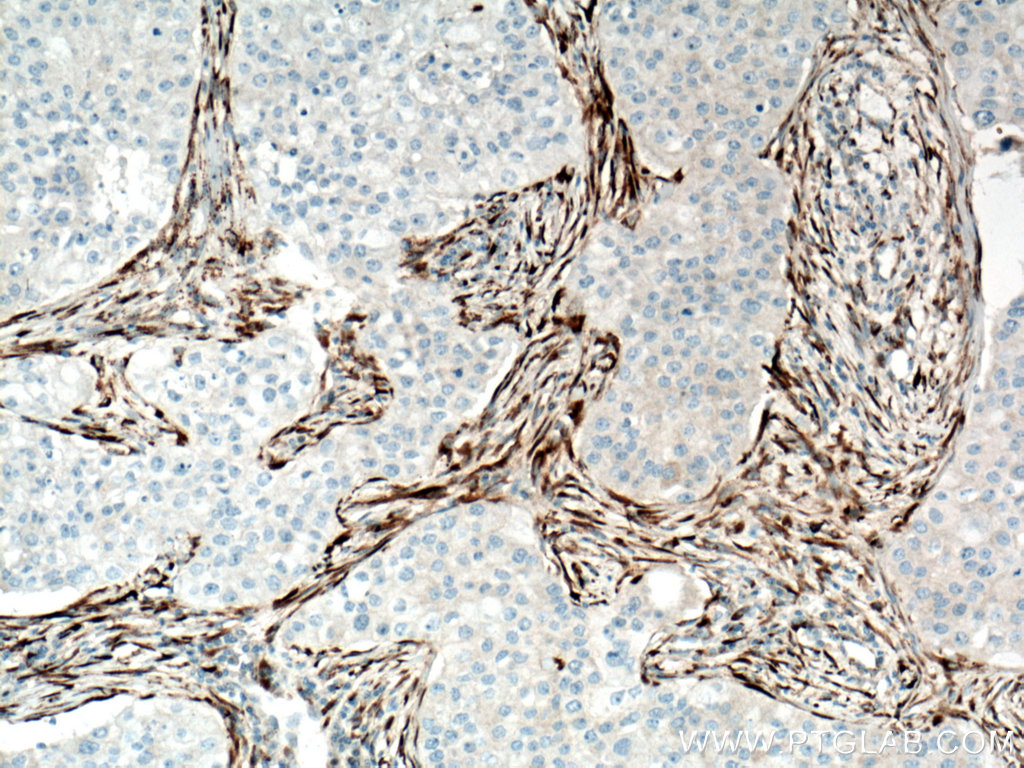 Collagen Type I Monoclonal antibody