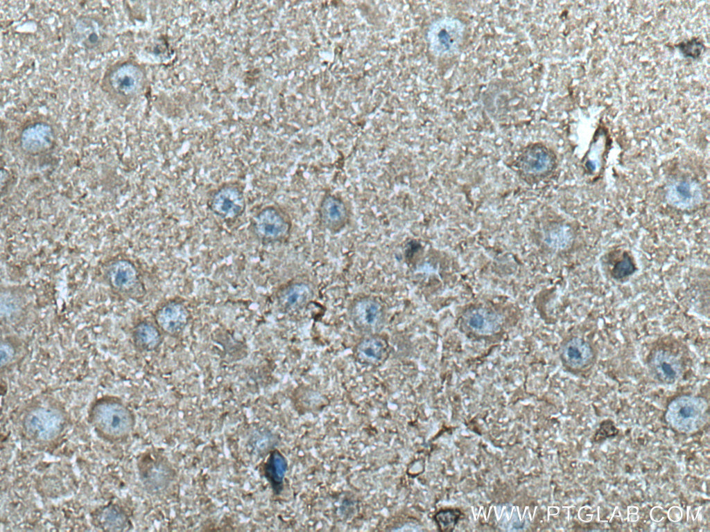 CKB Monoclonal antibody