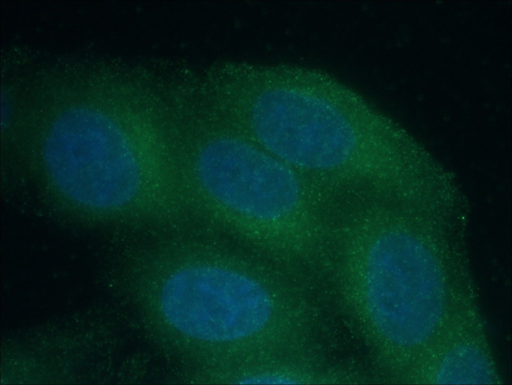 Catalase Monoclonal antibody