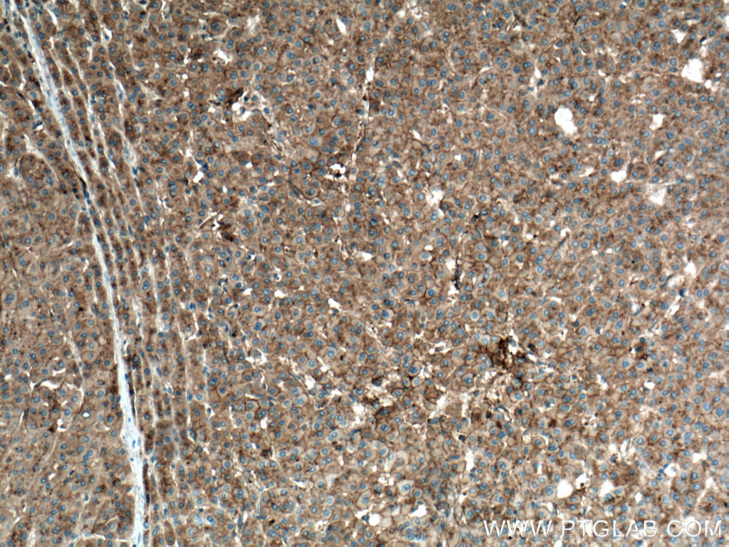 Apolipoprotein A II Monoclonal antibody