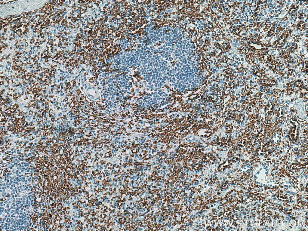 Glycophorin A  Monoclonal antibody