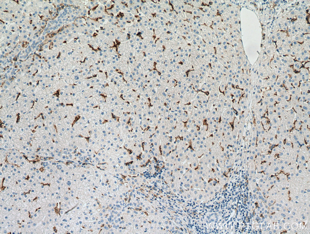CD16 Monoclonal antibody
