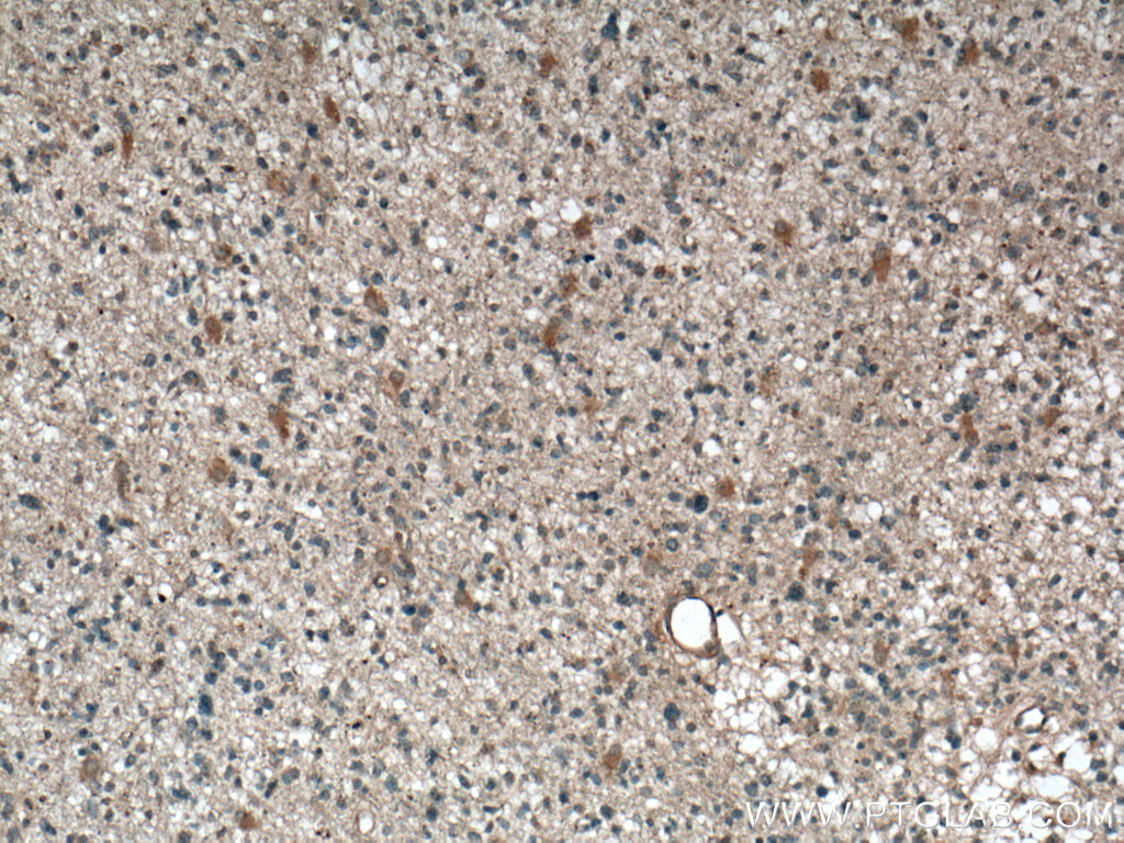 Neuromedin B Monoclonal antibody