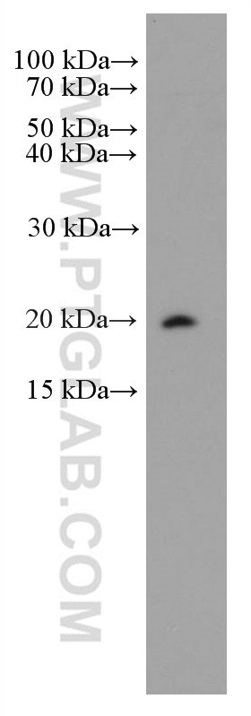 CD52 Monoclonal antibody