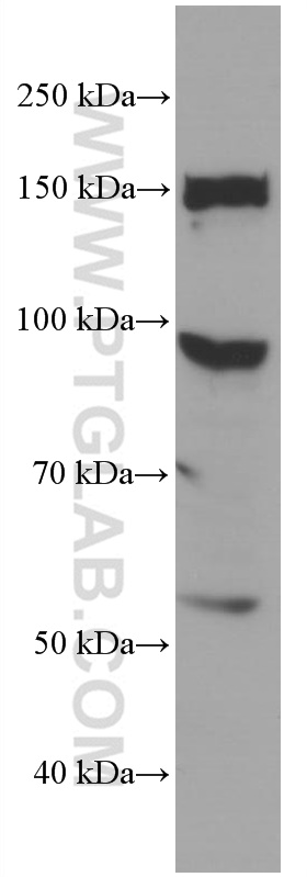 CFP Monoclonal antibody