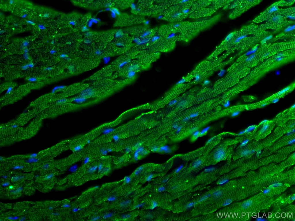 SOCS3 Monoclonal antibody