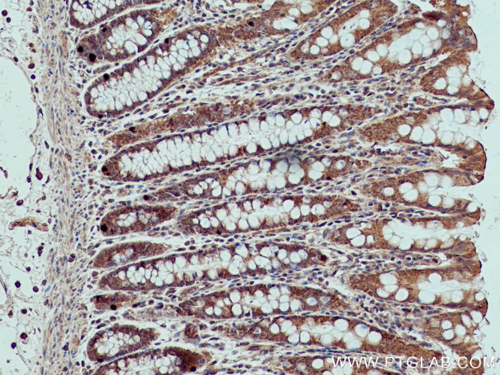 XIAP Monoclonal antibody