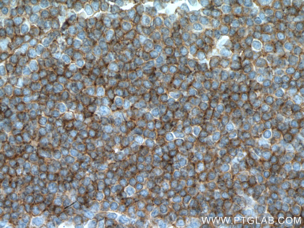 CCR6 Monoclonal antibody