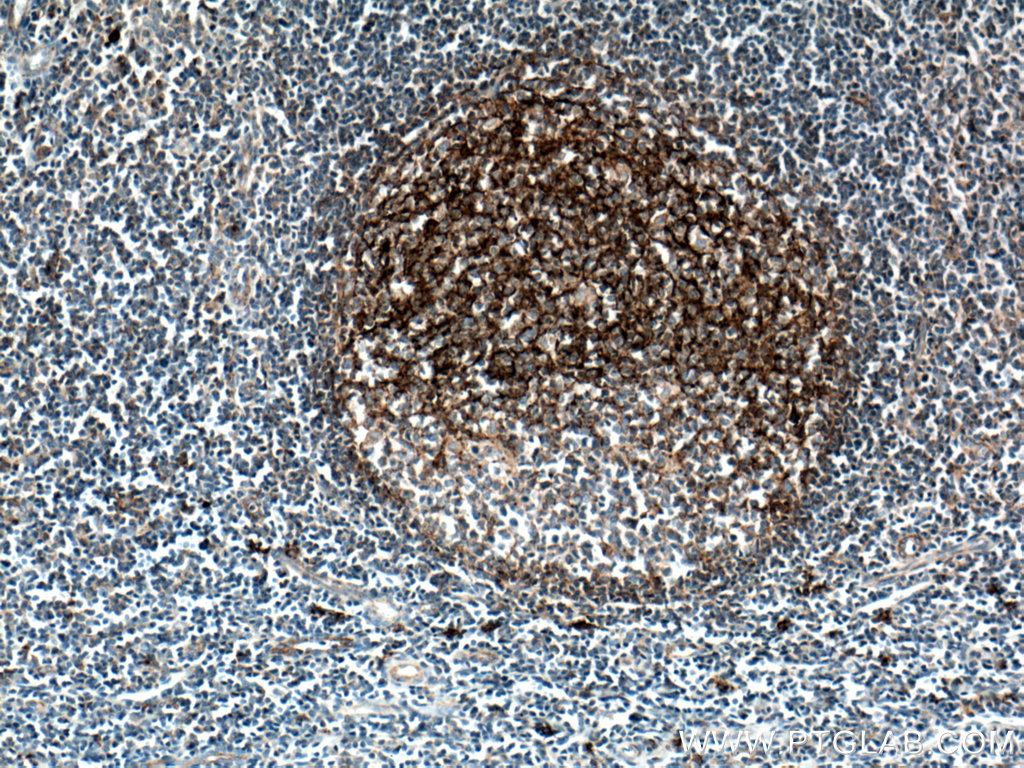 CD82 Monoclonal antibody