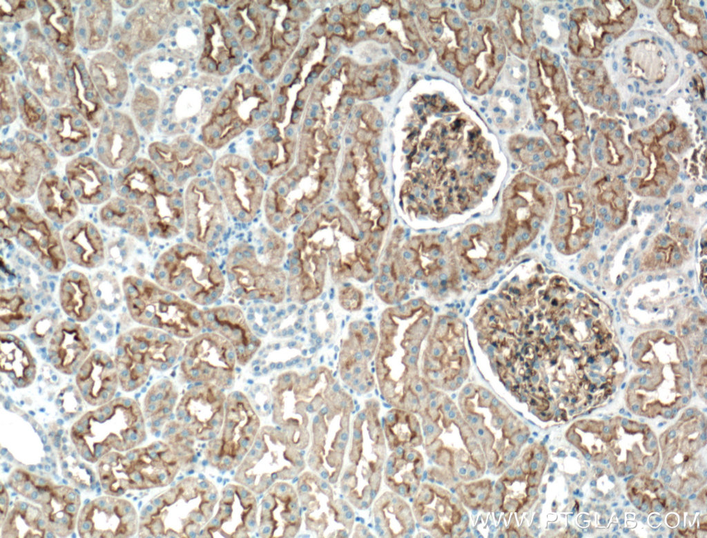 AQP1 Monoclonal antibody