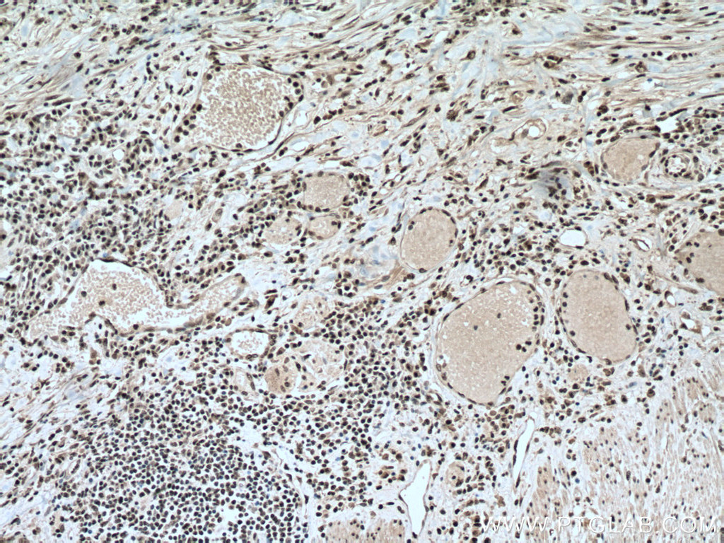 PABPN1 Monoclonal antibody