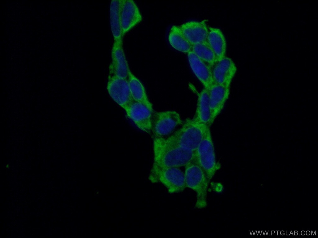PABPC1,PABP Monoclonal antibody