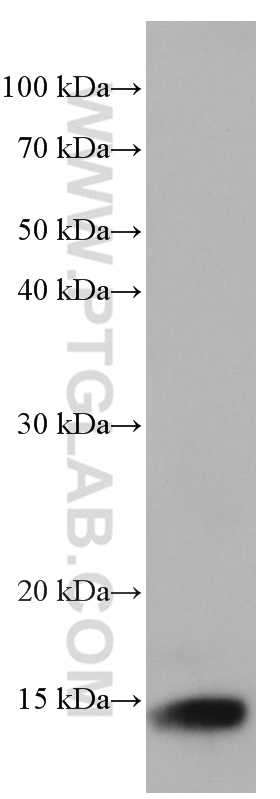 Cystatin B Monoclonal antibody