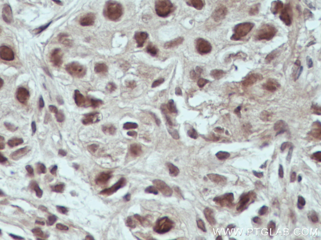 USP4 Monoclonal antibody