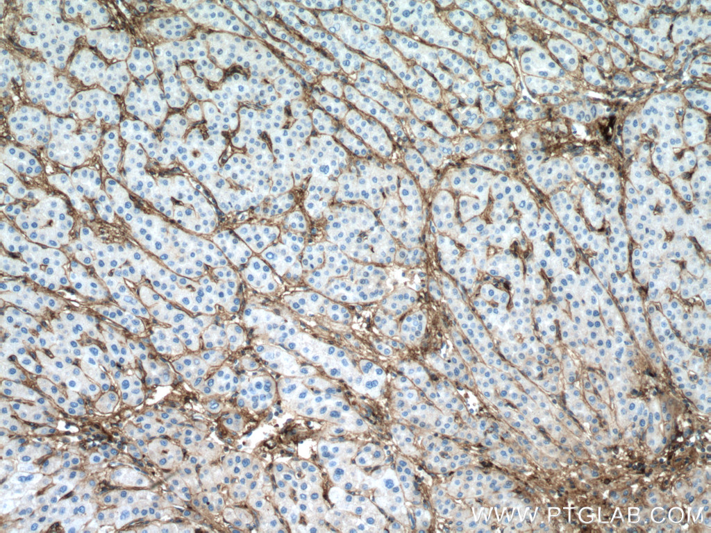Collagen Type VI  Monoclonal antibody