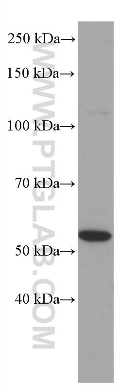 PPARA Monoclonal antibody