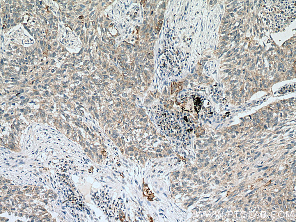VEGFA Monoclonal antibody