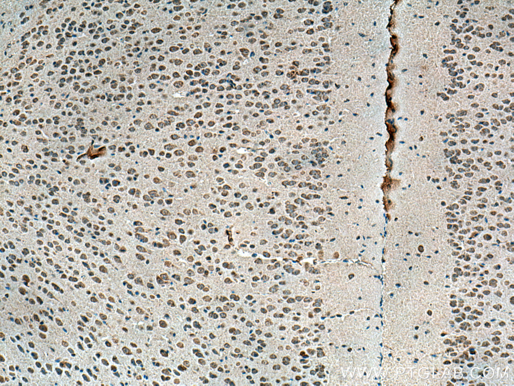 APOE Monoclonal antibody