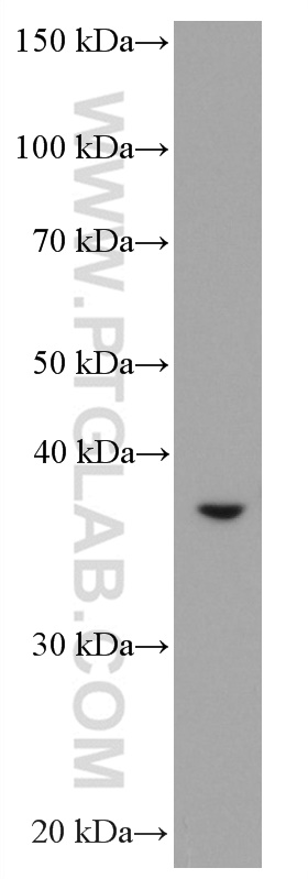 ASGR2 Monoclonal antibody