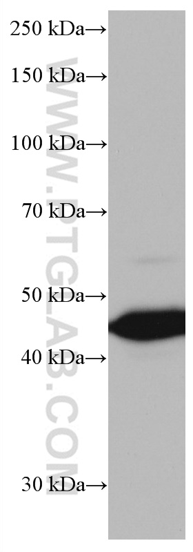 AGER Monoclonal antibody