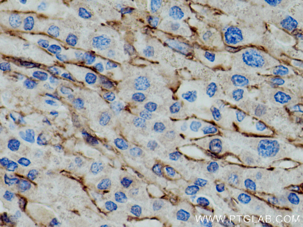 AOC3 Monoclonal antibody