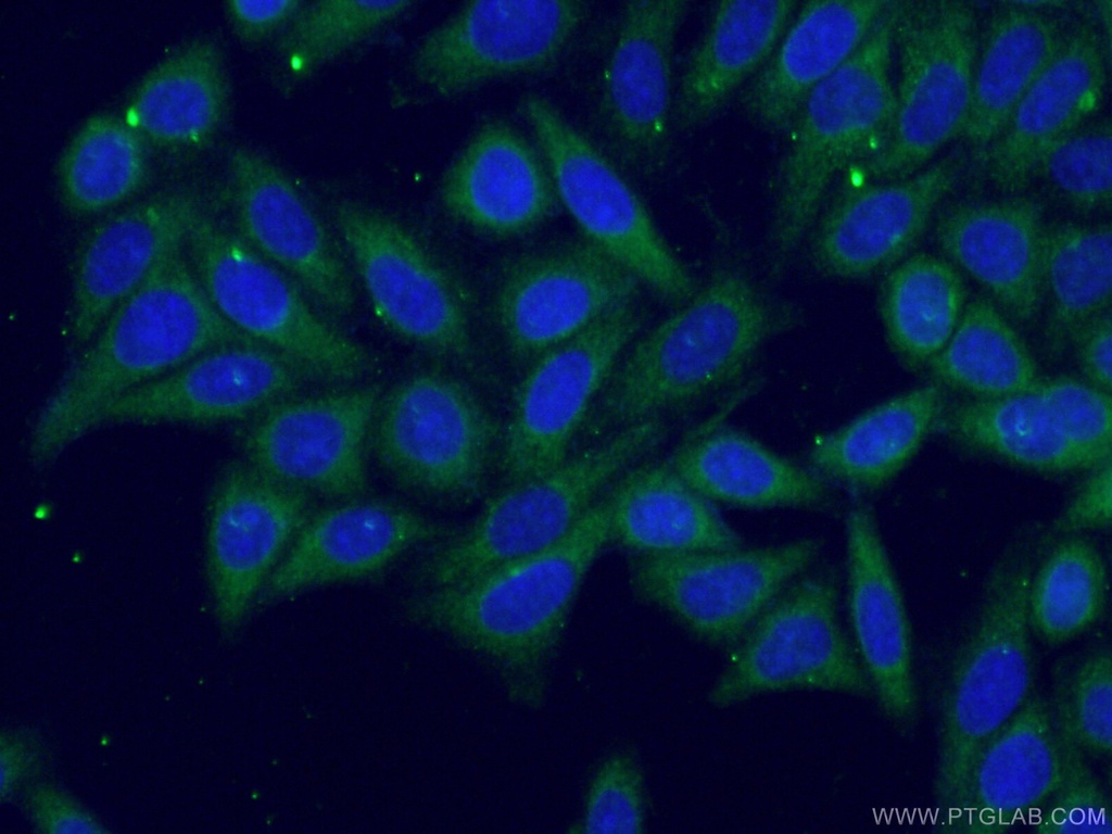 TDRKH Monoclonal antibody