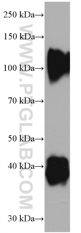 Decorin Monoclonal antibody