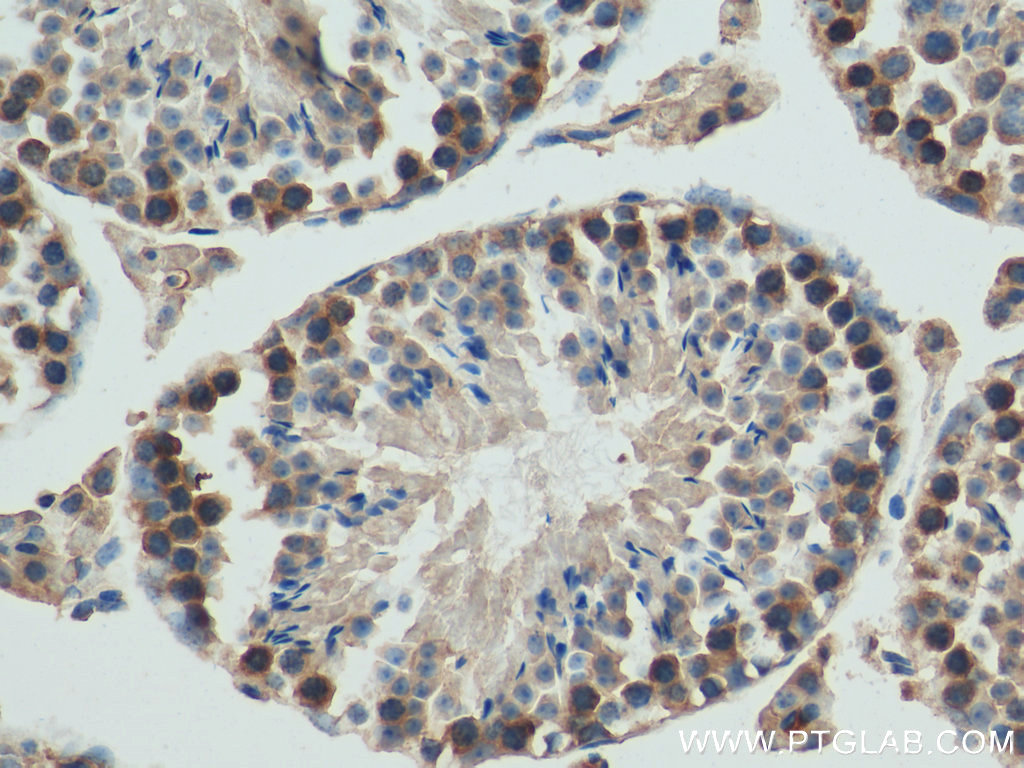 JTV1 Monoclonal antibody