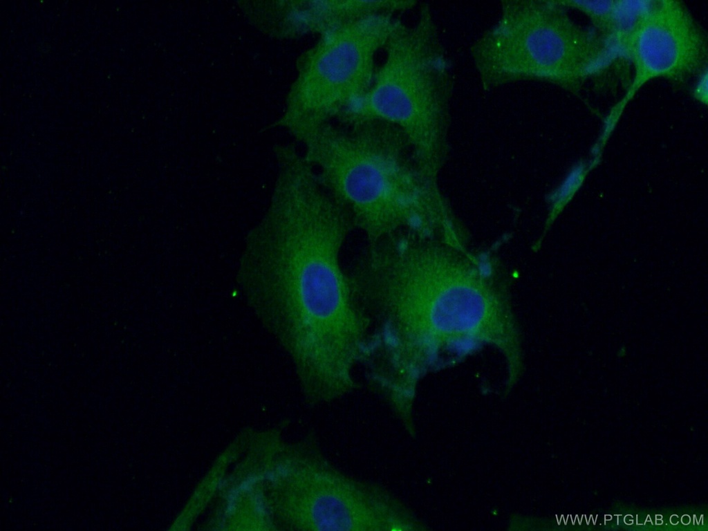 CPLX2 Monoclonal antibody