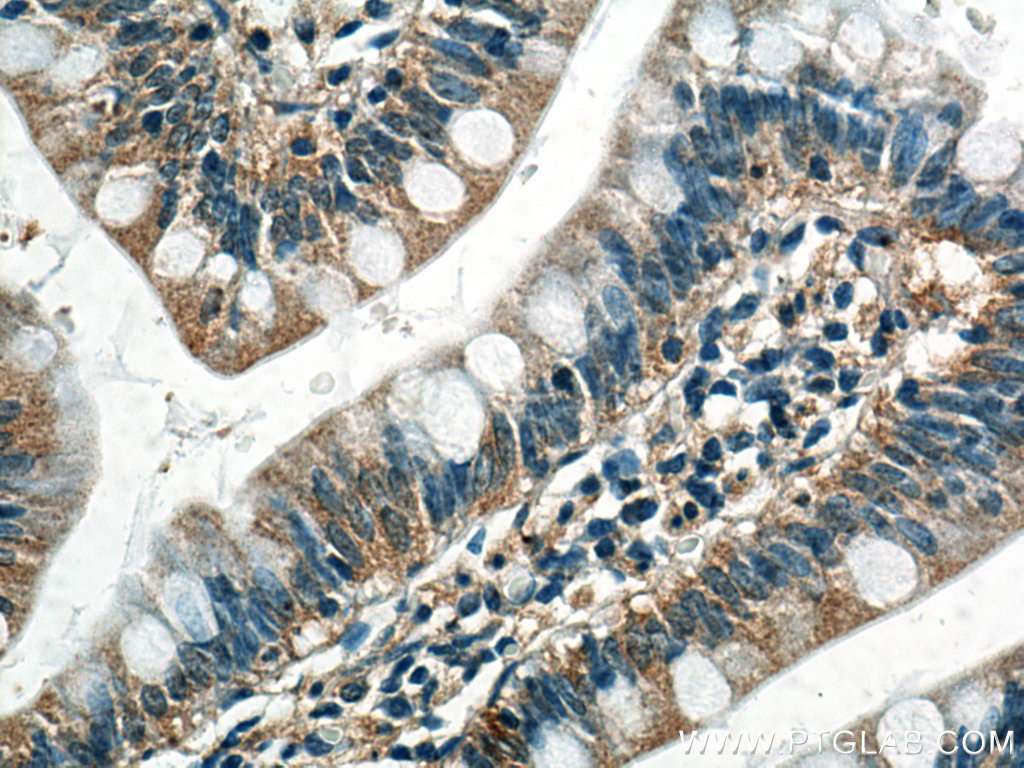 Phospho-RIPK1 (Ser161)  Monoclonal antibody