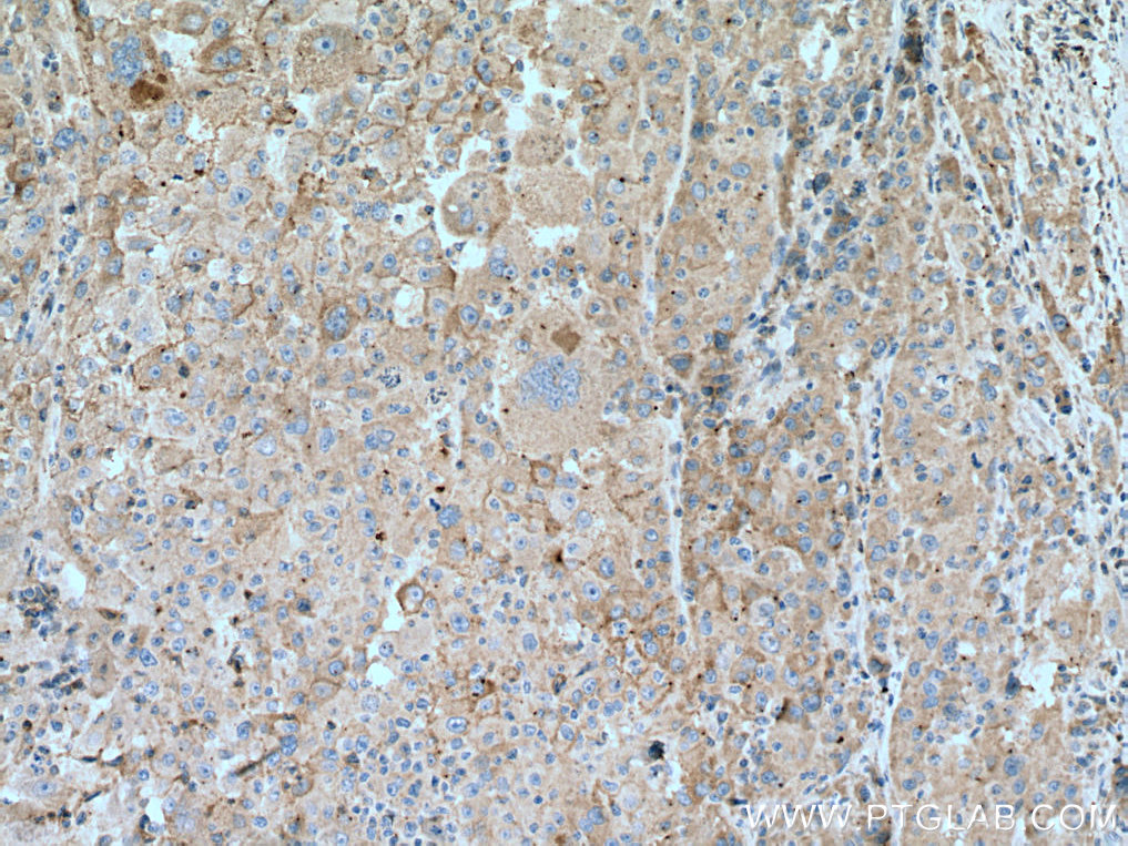 IL-6R Monoclonal antibody