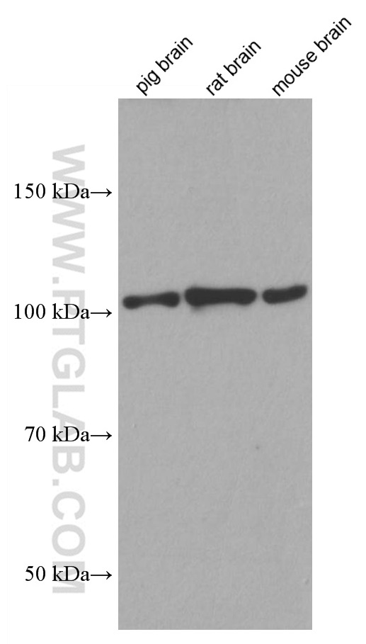 CYLD Monoclonal antibody