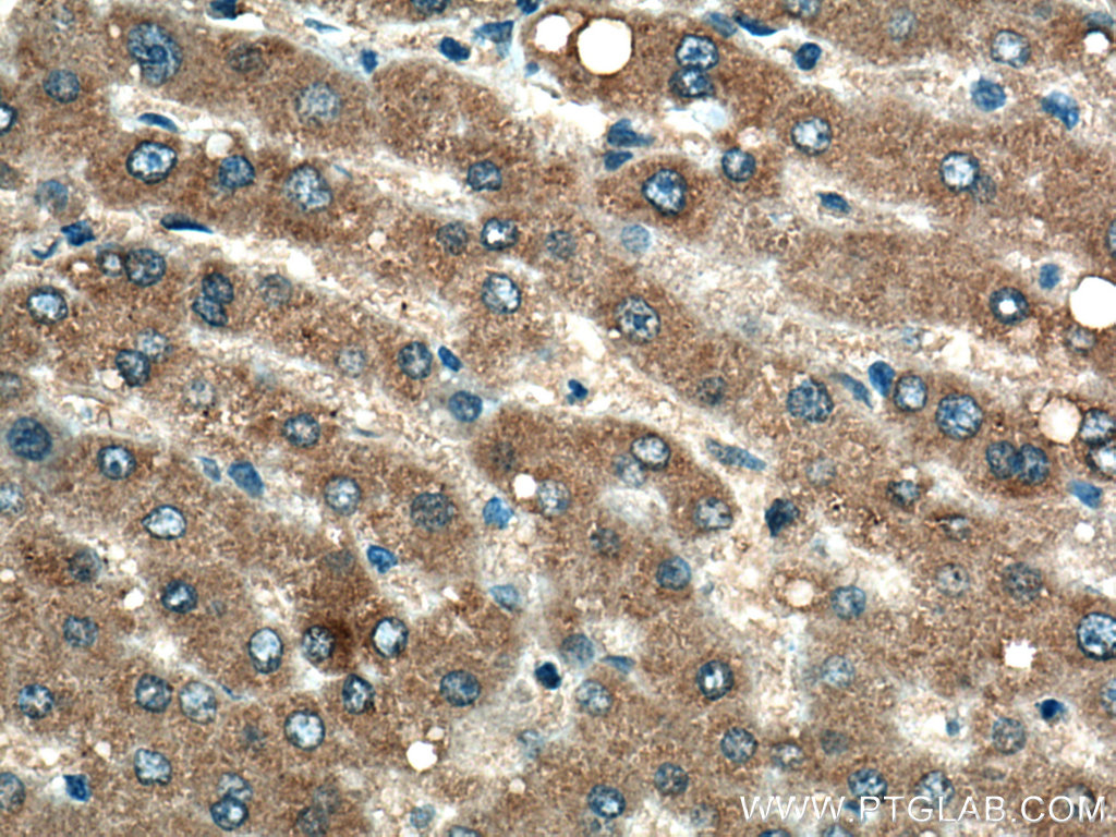 G6PC Monoclonal antibody