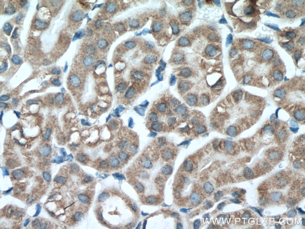 PCK1 Monoclonal antibody