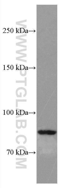 SMYD4 Monoclonal antibody
