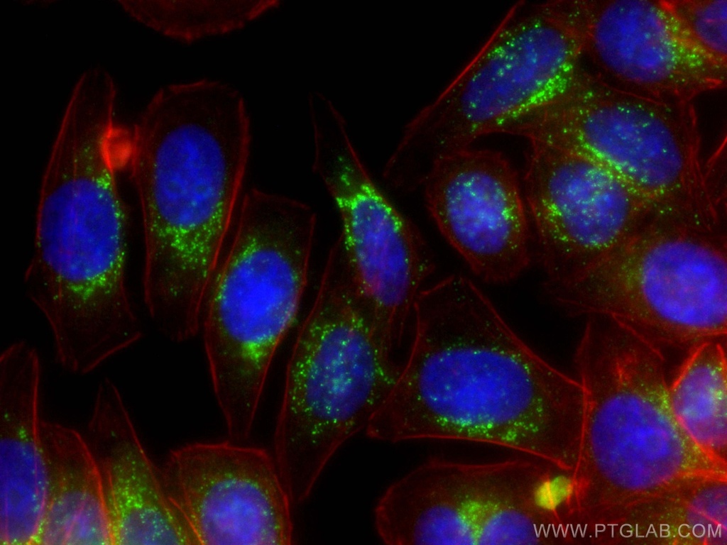 SREBF1 Monoclonal antibody